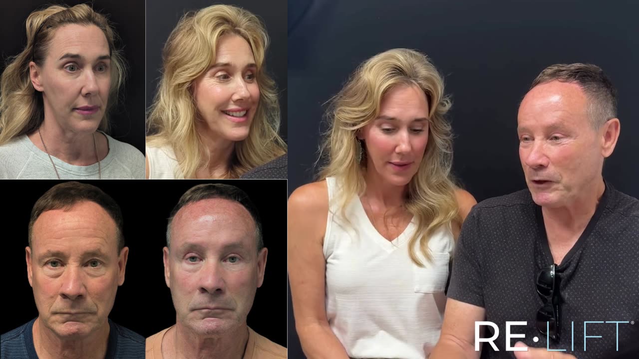 ReLift patients before and after, with Dr. Summers